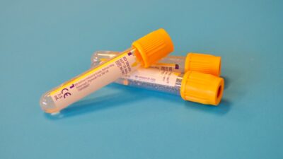 white and orange plastic tube