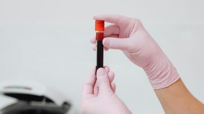 Close-up of gloved hands holding a blood sample in a test tube, ideal for medical and lab contexts.
