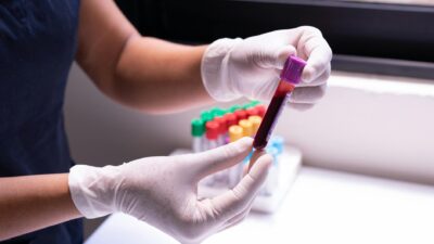 Gloved hands carefully handling a blood sample in a medical or laboratory environment.