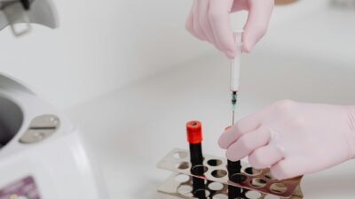 Close-up of lab technician's hands with gloves handling blood samples.