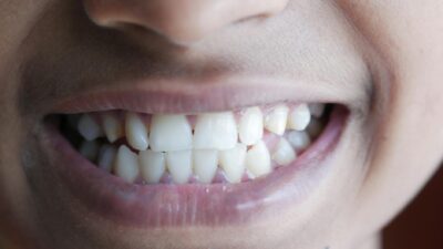 Close-up image of a person's smile highlighting teeth and lips, vibrant and cheerful.