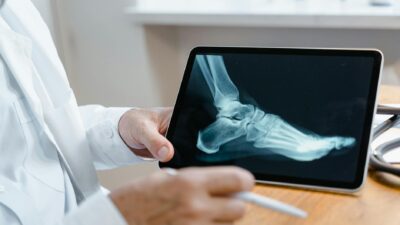 Doctor examining a foot X-ray image on a digital tablet using a stylus in a medical office.