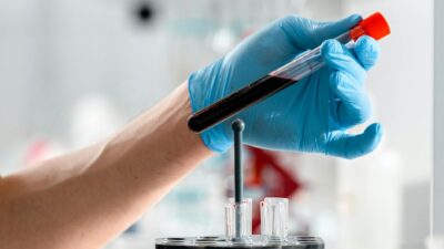 Close-up of a gloved hand holding a test tube with blood sample in a clinical research lab.